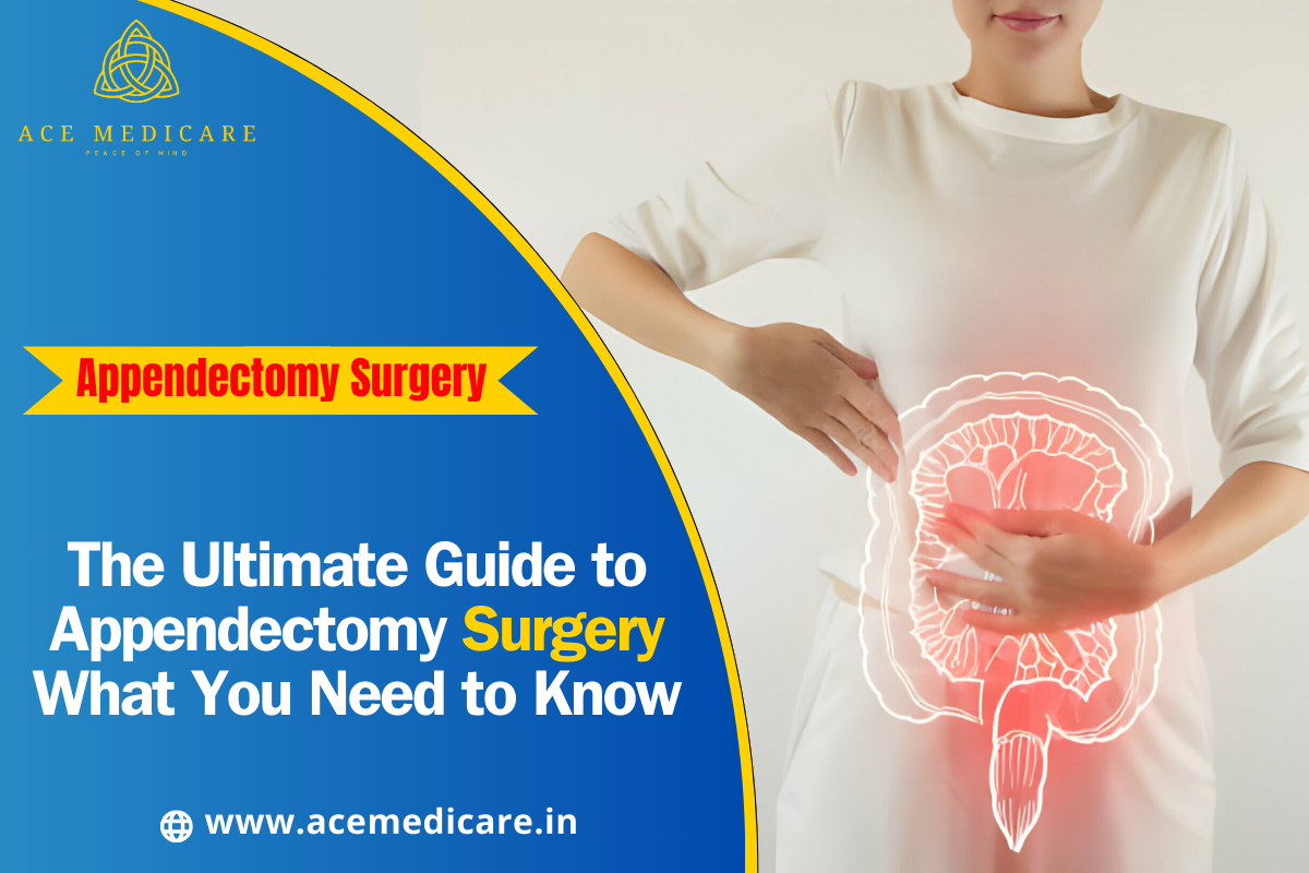 The Ultimate Guide to Appendectomy Surgery: What You Need to Know